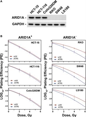 Selective vulnerability of ARID1A deficient colon cancer cells to combined radiation and ATR-inhibitor therapy